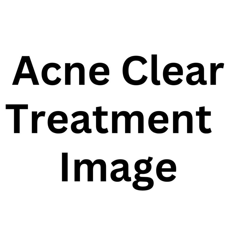 Acne Clear Treatment